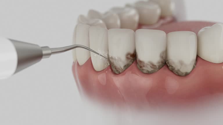 Trusted Root Canal Treatment service in Castle Rock, WA - Dentist Open Now